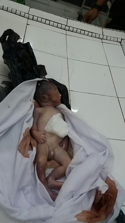 Geger! Warga Temukan Mayat Bayi Laki-laki Dalam Plastik Hitam 